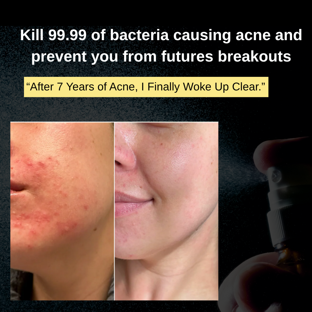 Dermashield Facial Spray