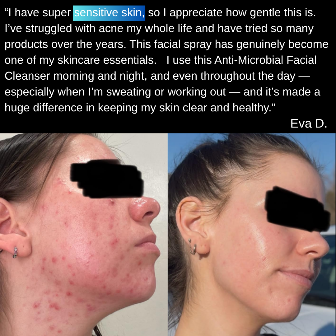 Dermashield Facial Spray